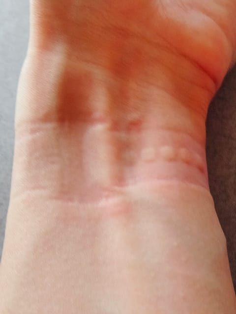 時計のバンドが食い込んだ腕